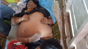 Diduga Sakit Paru-paru Basah, Seorang WN Singapura Meninggal di Pulau Tunjuk Batam