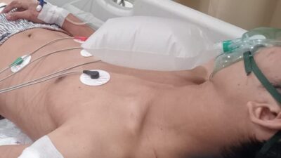 Horor Dini Hari di Batam Kota! Pria 24 Tahun Kritis Ditusuk Diduga Genk Motor